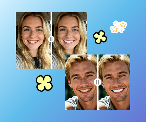 What is AI Teeth Whitening??