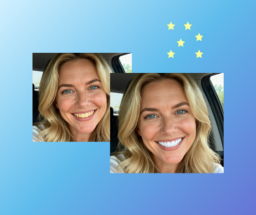 Why AI Teeth Whitening is Recommended